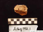 L_V20d5029 A16q142.1 R820 lR ta osteoarthritis.JPG L_V20d5029 A16q142.1 R820 lR ta osteoarthritis